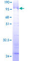 RRP1 Protein - 12.5% SDS-PAGE of human D21S2056E stained with Coomassie Blue