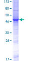 RS1 / Retinoschisin 1 Protein - 12.5% SDS-PAGE of human RS1 stained with Coomassie Blue