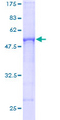 RSU1 Protein - 12.5% SDS-PAGE of human RSU1 stained with Coomassie Blue