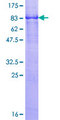 RTN2 / Reticulon 2 Protein - 12.5% SDS-PAGE of human RTN2 stained with Coomassie Blue