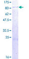 RUFY1 Protein - 12.5% SDS-PAGE of human RUFY1 stained with Coomassie Blue
