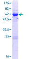 RWDD1 Protein - 12.5% SDS-PAGE of human RWDD1 stained with Coomassie Blue