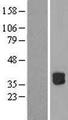 RWDD2B / C21orf6 Protein - Western validation with an anti-DDK antibody * L: Control HEK293 lysate R: Over-expression lysate