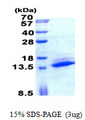 SAMD13 Protein