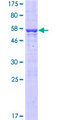 SARNP / Hcc-1 / CIP29 Protein - 12.5% SDS-PAGE of human CIP29 stained with Coomassie Blue