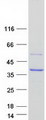 SCAMP1 / SCAMP Protein - Purified recombinant protein SCAMP1 was analyzed by SDS-PAGE gel and Coomassie Blue Staining