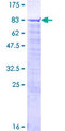 SCFD1 / SLY1 Protein - 12.5% SDS-PAGE of human SCFD1 stained with Coomassie Blue