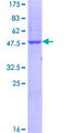 SCN1B Protein - 12.5% SDS-PAGE of human SCN1B stained with Coomassie Blue