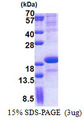 SCN3B Protein