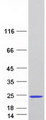 SCOC Protein - Purified recombinant protein SCOC was analyzed by SDS-PAGE gel and Coomassie Blue Staining