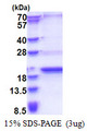 SCP2D1 / C20orf79 Protein