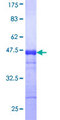 SCYL1 / NTKL Protein - 12.5% SDS-PAGE Stained with Coomassie Blue.
