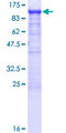 SCYL3 Protein - 12.5% SDS-PAGE of human SCYL3 stained with Coomassie Blue