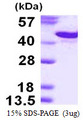 SDC1 / Syndecan 1 / CD138 Protein