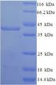 SDC1 / Syndecan 1 / CD138 Protein