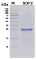 SDF2 Protein - SDS-PAGE under reducing conditions and visualized by Coomassie blue staining