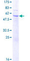 SDR39U1 Protein - 12.5% SDS-PAGE of human C14orf124 stained with Coomassie Blue