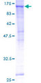 SEC24C Protein - 12.5% SDS-PAGE of human SEC24C stained with Coomassie Blue
