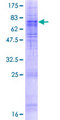 SEC61A2 Protein - 12.5% SDS-PAGE of human SEC61A2 stained with Coomassie Blue