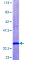 SELK / Selenoprotein K Protein - 12.5% SDS-PAGE of human SELK stained with Coomassie Blue