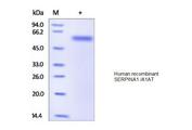 SERPINA1 / Alpha 1 Antitrypsin Protein