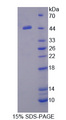 SERPINA5 / PCI Protein - Recombinant Protein C Inhibitor By SDS-PAGE