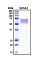 SERPINB4 / SCCA1+2 Protein - SDS-PAGE under reducing conditions and visualized by Coomassie blue staining