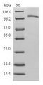 SERPINB9 / PI9 Protein - (Tris-Glycine gel) Discontinuous SDS-PAGE (reduced) with 5% enrichment gel and 15% separation gel.