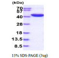 SERPINE1 / PAI-1 Protein