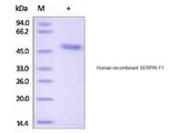 SERPINF1 / PEDF Protein