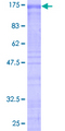 SF3B2 Protein - 12.5% SDS-PAGE of human SF3B2 stained with Coomassie Blue