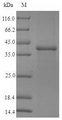 SFTPA1 / Surfactant Protein A Protein - (Tris-Glycine gel) Discontinuous SDS-PAGE (reduced) with 5% enrichment gel and 15% separation gel.