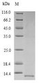 SFTPB / Surfactant Protein B Protein - (Tris-Glycine gel) Discontinuous SDS-PAGE (reduced) with 5% enrichment gel and 15% separation gel.