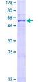 SFXN2 Protein - 12.5% SDS-PAGE of human SFXN2 stained with Coomassie Blue
