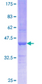 SFXN3 / Sideroflexin 3 Protein - 12.5% SDS-PAGE Stained with Coomassie Blue.
