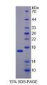 SH3BGRL Protein - Recombinant SH3 Domain Binding Glutamic Acid Rich Protein Like Protein By SDS-PAGE