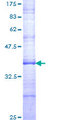 SHFM3 / FBXW4 Protein - 12.5% SDS-PAGE Stained with Coomassie Blue.