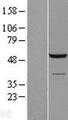 SHPK / CARKL Protein - Western validation with an anti-DDK antibody * L: Control HEK293 lysate R: Over-expression lysate