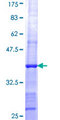 SHPRH Protein - 12.5% SDS-PAGE Stained with Coomassie Blue.