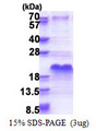 SHSF1 / SHFM1 Protein