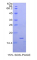 SIGLEC1 / CD169 / Sialoadhesin Protein - Recombinant Sialic Acid Binding Ig Like Lectin 1 By SDS-PAGE