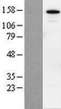 SIN3B Protein - Western validation with an anti-DDK antibody * L: Control HEK293 lysate R: Over-expression lysate