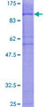SIPA1L2 Protein - 12.5% SDS-PAGE of human SIPA1L2 stained with Coomassie Blue