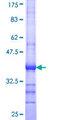 SKIV2L / SKI2 Protein - 12.5% SDS-PAGE Stained with Coomassie Blue.