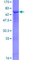 SKP2 Protein - 12.5% SDS-PAGE of human SKP2 stained with Coomassie Blue