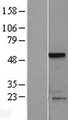 SLAIN1 Protein - Western validation with an anti-DDK antibody * L: Control HEK293 lysate R: Over-expression lysate