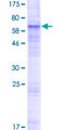 SLC10A6 Protein - 12.5% SDS-PAGE of human SLC10A6 stained with Coomassie Blue