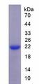 SLC12A3 / TSC Protein - Recombinant Na-Cl Cotransporter By SDS-PAGE
