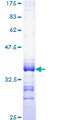 SLC19A2 / TC1 Protein - 12.5% SDS-PAGE Stained with Coomassie Blue.