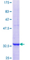 SLC25A16 / GDA / Graves Protein - 12.5% SDS-PAGE Stained with Coomassie Blue.